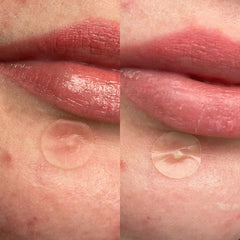 Hero. Mighty Patch Duo Anti-Pimple Επιθέματα για Σπυράκια, 12τεμ