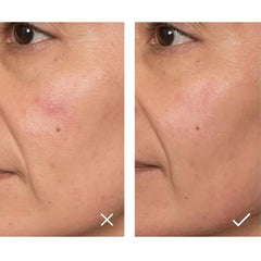 Caudalie Promo Vinopure Blemish Control Salicylic Serum Ορός Προσώπου κατά των Ατελειών, 30ml & Δώρο Vinopure Purifying Toner Φροντίδα κατά των Ατελειών, 200ml, 1σετ