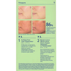 Caudalie Promo Vinopure Blemish Control Salicylic Serum Ορός Προσώπου κατά των Ατελειών, 30ml & Δώρο Vinopure Purifying Toner Φροντίδα κατά των Ατελειών, 200ml, 1σετ
