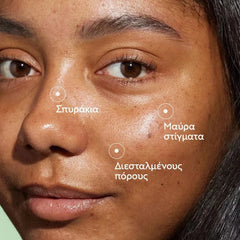 Caudalie Promo Vinopure Blemish Control Salicylic Serum Ορός Προσώπου κατά των Ατελειών, 30ml & Δώρο Vinopure Purifying Toner Φροντίδα κατά των Ατελειών, 200ml, 1σετ