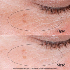 Neutrogena Collagen Bank Αναζωογονητική Κρέμα Gel Ματιών με Κολλαγόνο, 15g