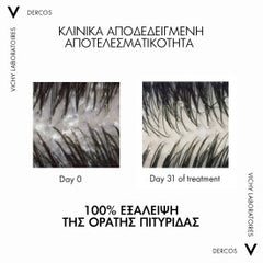VICHY DERCOS Anti-Dandruff DS 2σε1 Σαμπουάν & Conditioner κατά της ξηροδερμίας, της πιτυρίδας και του κνησμού