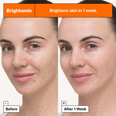 Dr. Jart+ Brightamin Brightening Serum Ampoule Αμπούλα Προσώπου, 8g