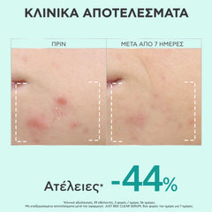 Apivita Just Bee Clear Serum Ορός Λείανσης για Ατέλειες & Σημάδια Ακμής, 30ml