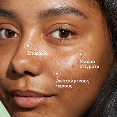 Caudalie Vinopure Blemish Control Salicylic Serum Ορός Προσώπου κατά των Ατελειών, 30ml