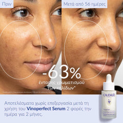 Caudalie Vinoperfect Dark Spot Brightening Serum Vitamin C Alternative 30ml
