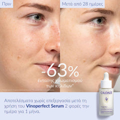 Caudalie Vinoperfect Dark Spot Brightening Serum Vitamin C Alternative 30ml
