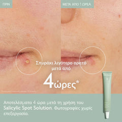Caudalie Vinopure Salicylic Spot Solution 15ml