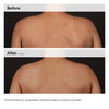 The Ordinary Body Care Salicylic Acid 0.5% Body Serum Ορός Σώματος για Απολέπιση, 240ml