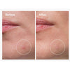 The Ordinary Sulfur 10% Powder to Cream Concentrate Συμπυκνωμένη Φόρμουλα κατά των Ατελειών & της Ακμής, 5g