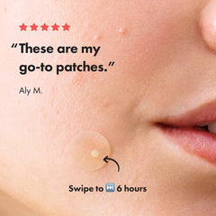 Hero. Mighty Patch The Original Anti-Pimple Επιθέματα για Σπυράκια, 24τεμ
