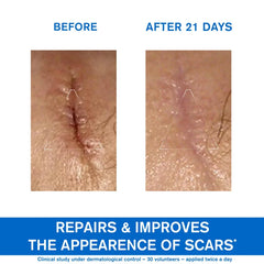 Uriage Bariederm Cica Creme Reparatrice 100ml