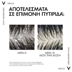 Vichy Dercos Anti-Dandruff DS Refill Σαμπουάν κατά της Ξηροδερμίας, της Πιτυρίδας και του Κνησμού για Κανονικά - Λιπαρά Μαλλιά Ανταλλακτικό, 390ml