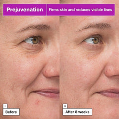 Dr. Jart+ Prejuvenation Bakuchiol Αντιγηραντικό Serum Προσώπου για Σύσφιξη 50ml