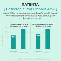 Apivita Just Bee Clear Serum Ορός Λείανσης για Ατέλειες & Σημάδια Ακμής, 30ml